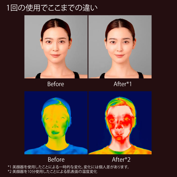 ELEKI LIFT　エレキリフト リフト美顔器　カラー３種　サロン級レベルの本格派